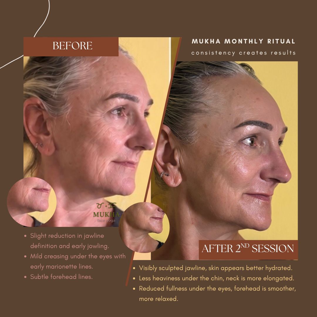 Mukha client before and after facial therapy Surbiton Surrey