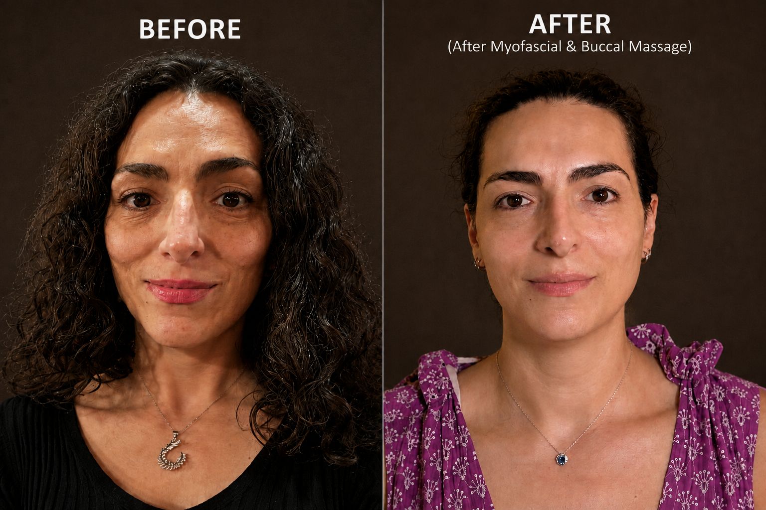 Mukha client before and after facial therapy treatment Surbiton Surrey