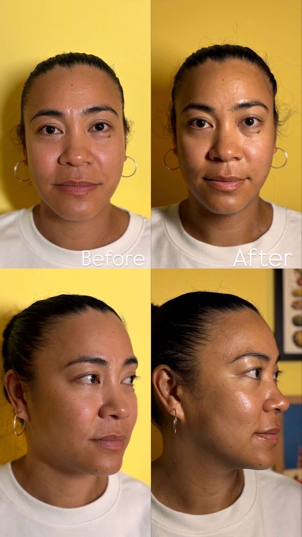 Mukha client before and after facial therapy treatment Surbiton Surrey